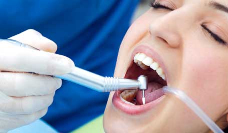 Besoin d'un détartrage ? Les chirurgiens-dentistes du cabinet dentaire Cibell s'occupent de vos dents et pratiquent le surfaçage - polissage pour un détartrage optimal.